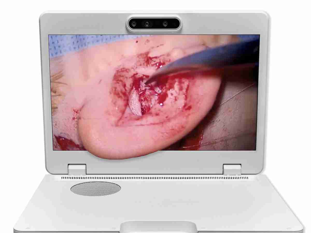 达擎之＂Heads-up 3D显微手术显示系统＂，，整合4K裸眼3D显示及眼球追踪系统，，，，具备快速追踪人眼移动位置功能，，减轻医师长时间维持固定姿势的负担，，让医师能有更宽广清晰的3D立体视野及更舒适的姿势来执行手术。。